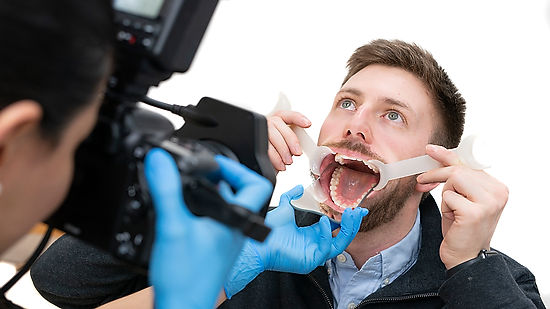 Live Dental Photography Demo